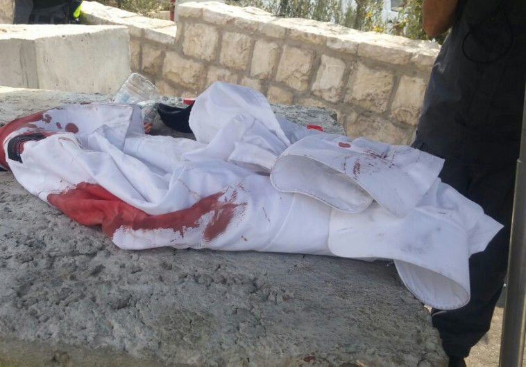 הבגד העקוב מדם שלבש הנדקר בירושלים. צילום: חטיבת דובר המשטרה
