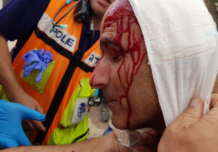 שוטר שנפצע במהלך הפגנה נגד פינוי נתיב האבות . צילום: דוברות המשטרה