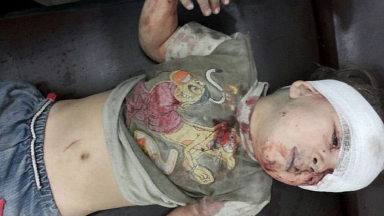 הילד שנפצע במהלך התקפה על עירו. צילום מסך