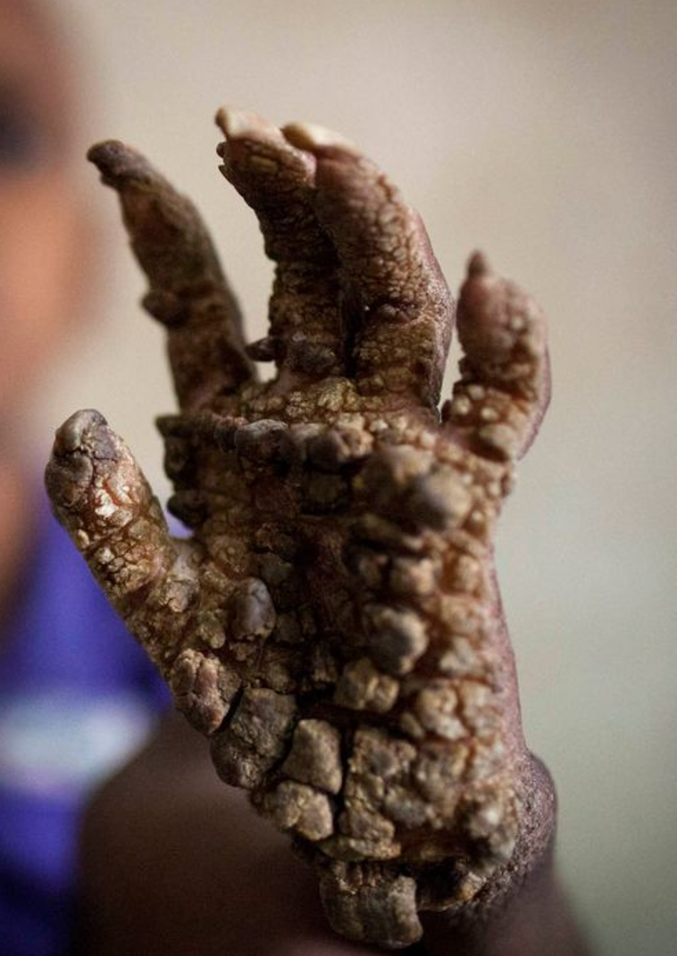 ינתחו אותו בבית החולים. צילום: מתוך אתר המירור