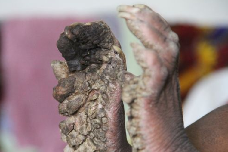 מתקשה לתפקד. צילום: מתוך אתר המירור