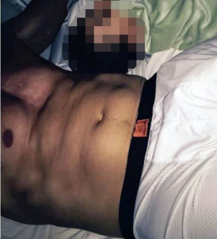 התמונה המביכה של אנתוני וינר