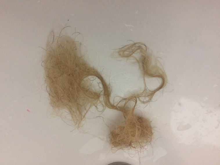 &quot;בכיתי וצרחתי&quot;. השערות שנתלשו