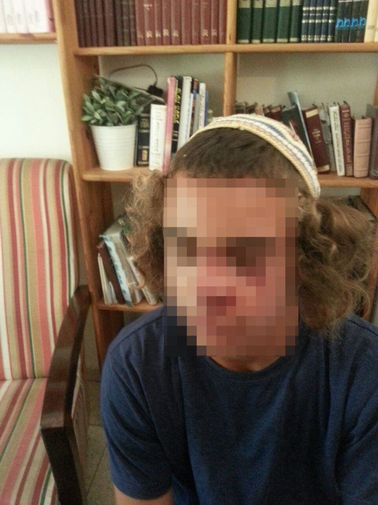 הנער שנפגע מאלימות שוטרים. צילום: ארגון חוננו