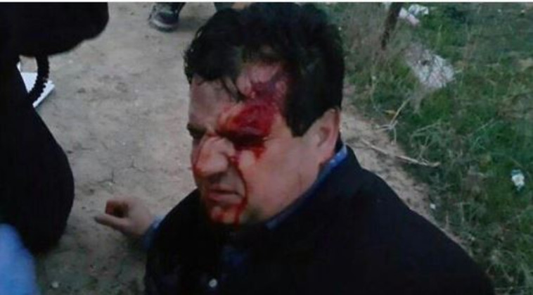 חבר הכנסת איימן עודה אחרי שנפגע בעימותים. צילום: טוויטר