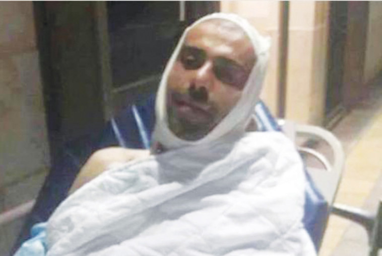 מועאד עאמר, זוהה בטעות כמחבל והוכה. צילום: פייסבוק