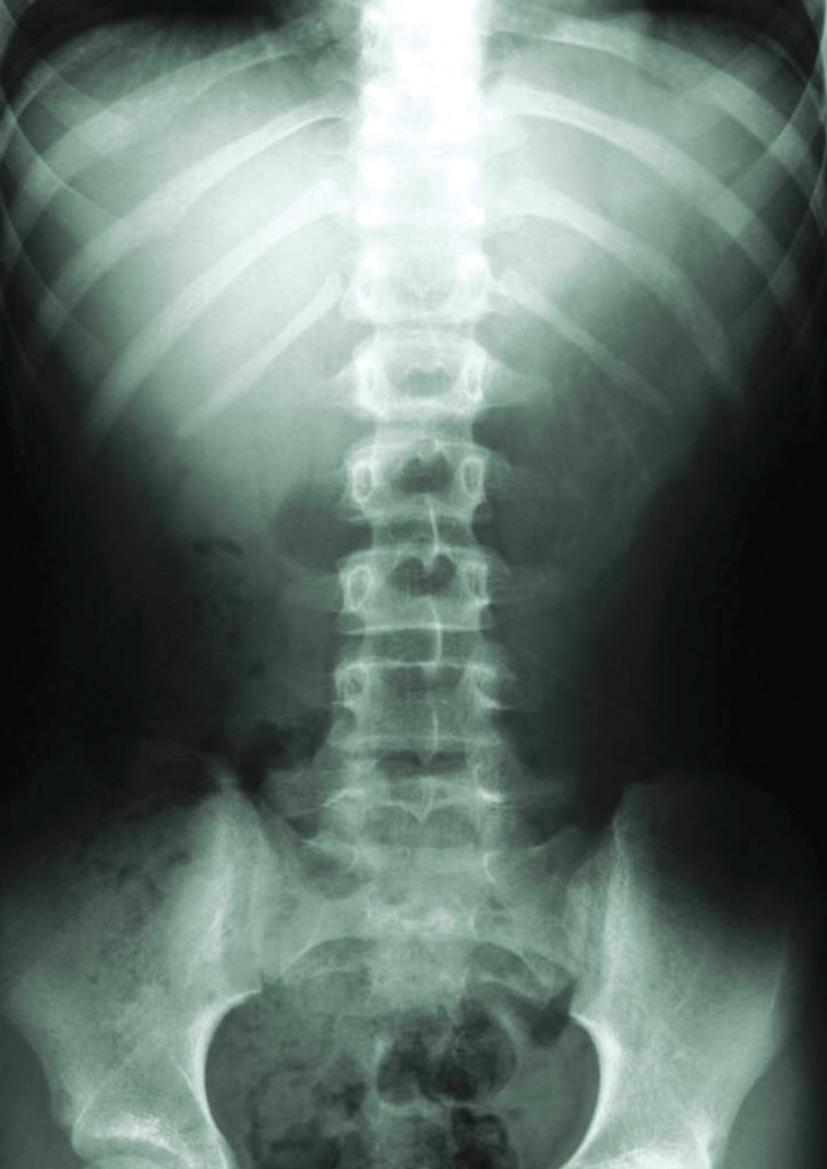 צילום רנטגן. לטענת התובעים, היה ניתן להבחין בגידול בזמן 