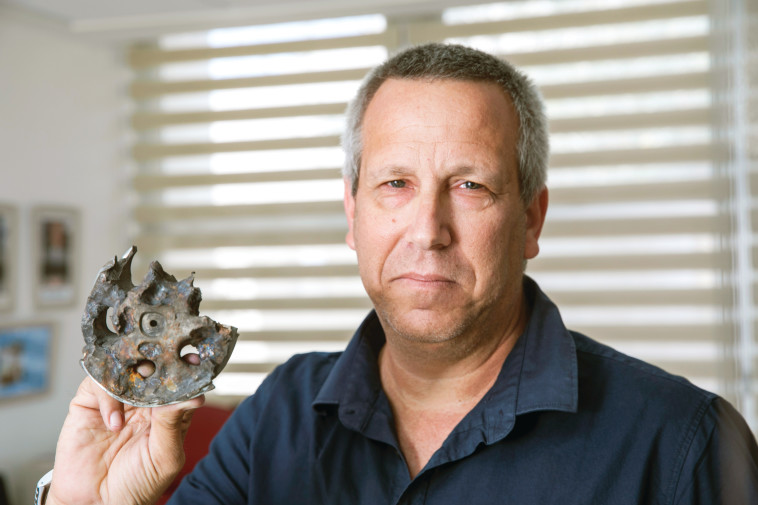 &quot;בבית לא עושים לי הנחות. אני שוטף כלים, מכין אוכל בשישי&quot;. ירקוני עם רסיס הפצמ&quot;ר שפגע בו צילום: יוסי אלוני