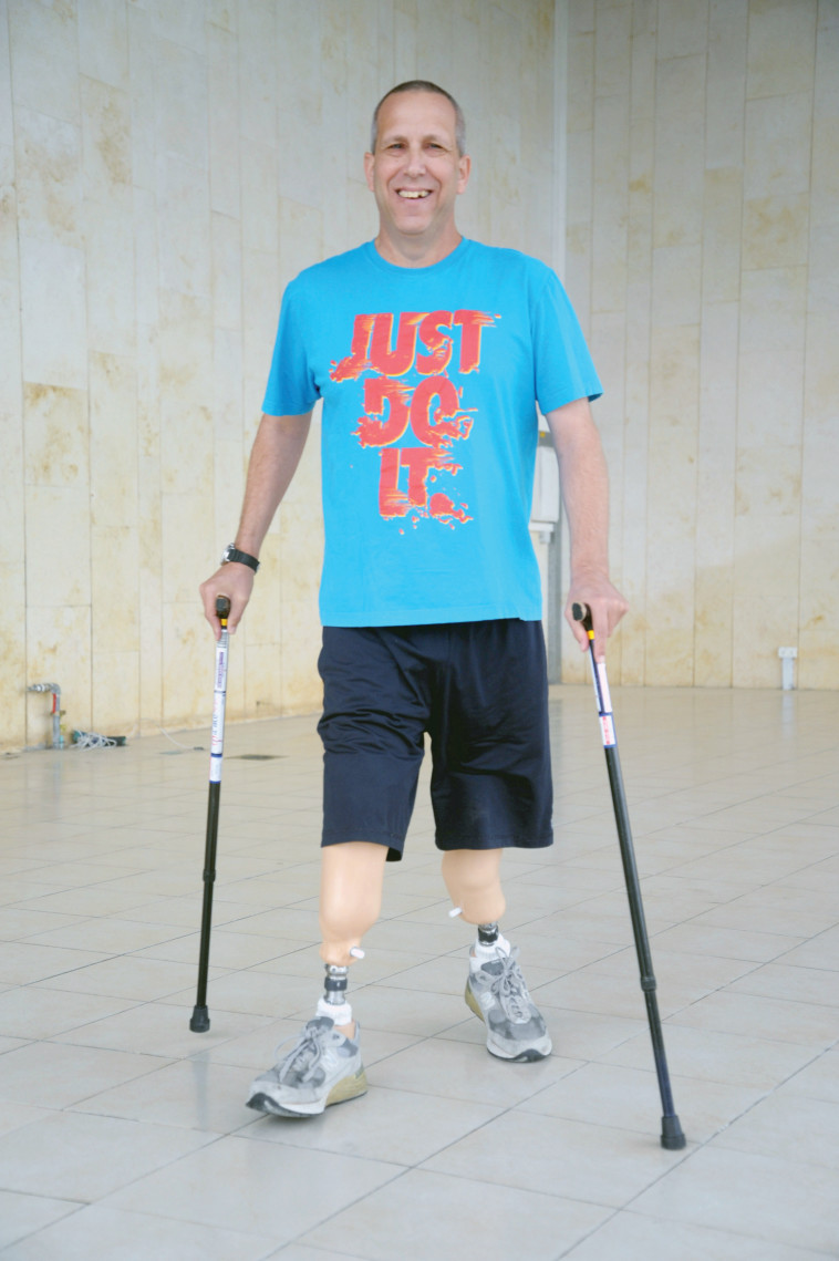 התיק הרפואי כולל גם פגיעה חמורה בראייה והתקף לב קשה. ירקוני משתחרר מבית החולים צילום: אבשלום ששוני