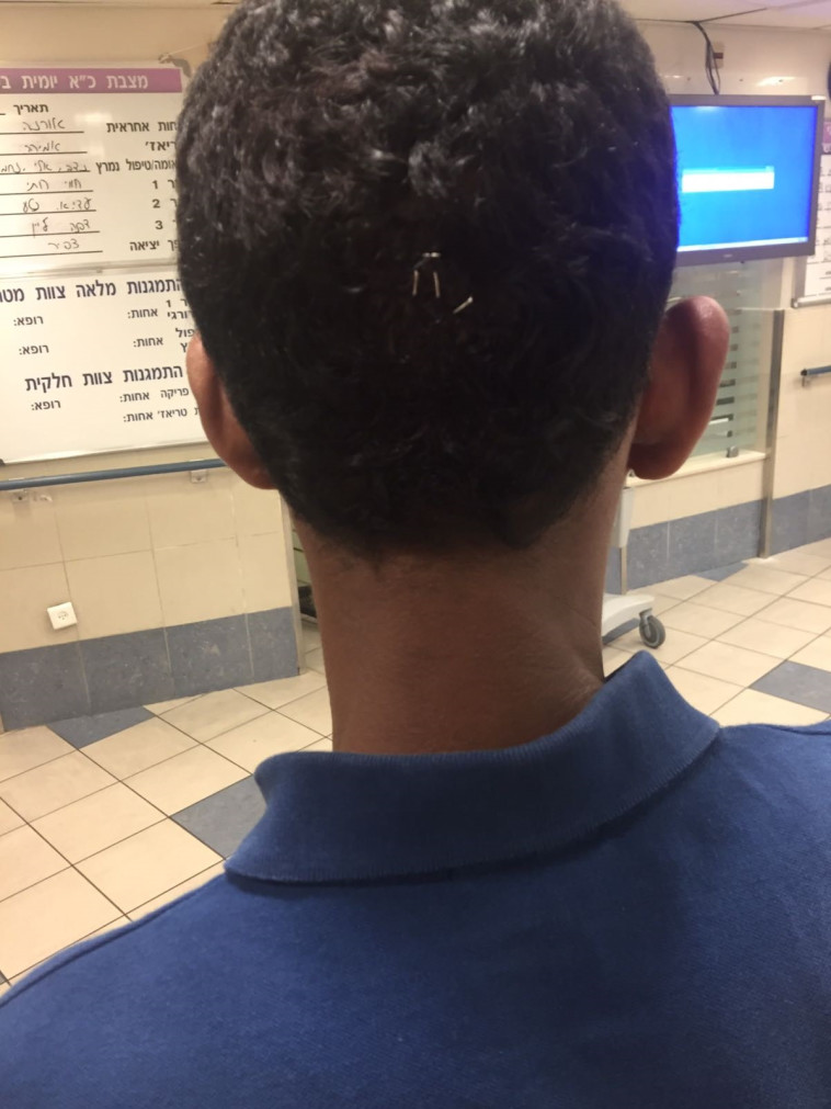 מאבטח שהותקף באירוע. צילום: דוברות איכילוב