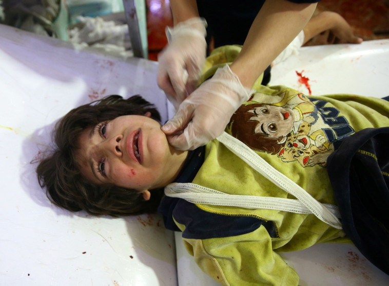 ילד מקבל טיפול רפואי, אחרי התקיפה אתמול. צילום: רויטרס