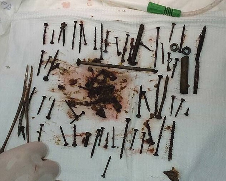 חלק מהמתכות שהוצאו מבטנה של נינה. צילום מסך