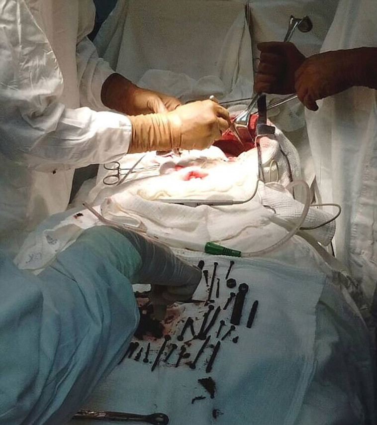 נינה על שולחן המנתחים. צילום מסך