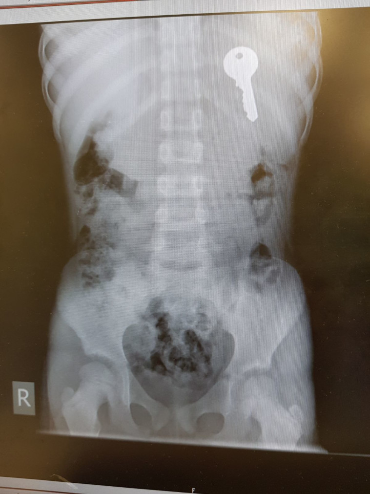 מפתח שנמצא בגופה של בת 6. צילום: דוברות טרם