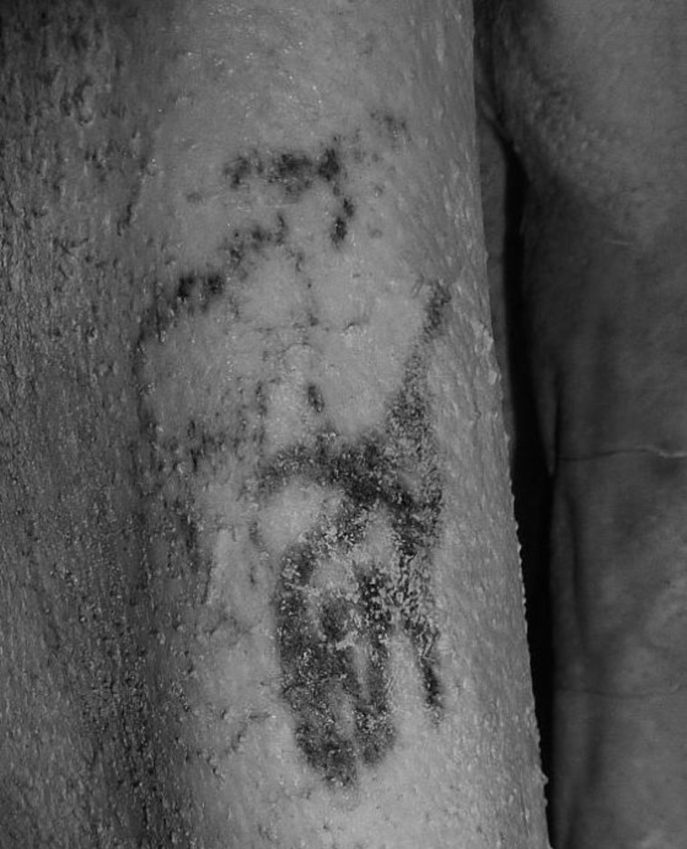 הקעקוע על זרועה של המומיה. צילום: המוזיאון הבריטי