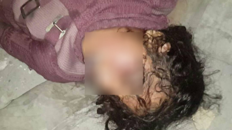 תקיפה כימית  בסוריה. צילום: רשתות ערביות