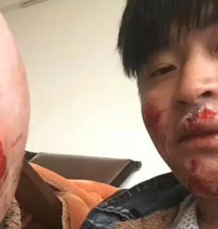 קיבל את המגיע? דחף קוף למים והותקף