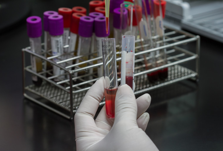 &quot; שילמנו רק 69 דולר, וזה שווה לי&quot;. צילום: אינג אימג'