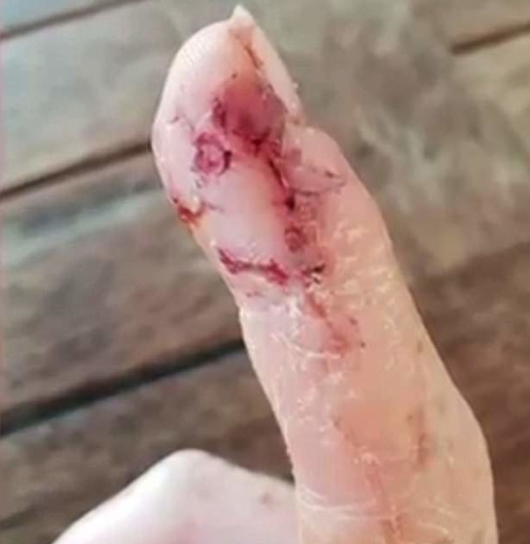 כנראה הוא חשב שזה אוכל? הנשיכה באצבע של ברונינג