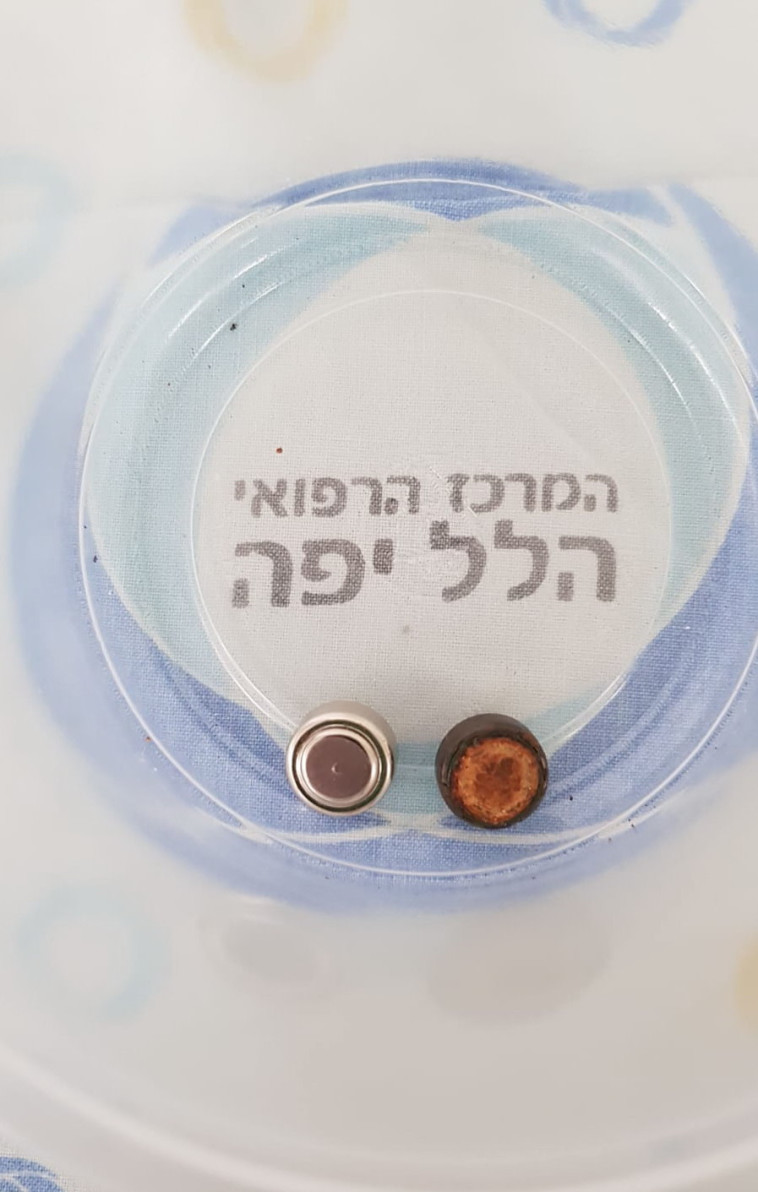 מימין: הסוללה שהוצאה מהקיבה, משמאל: סוללה תקינה. צילום: באדיבות המרכז הרפואי הלל יפה