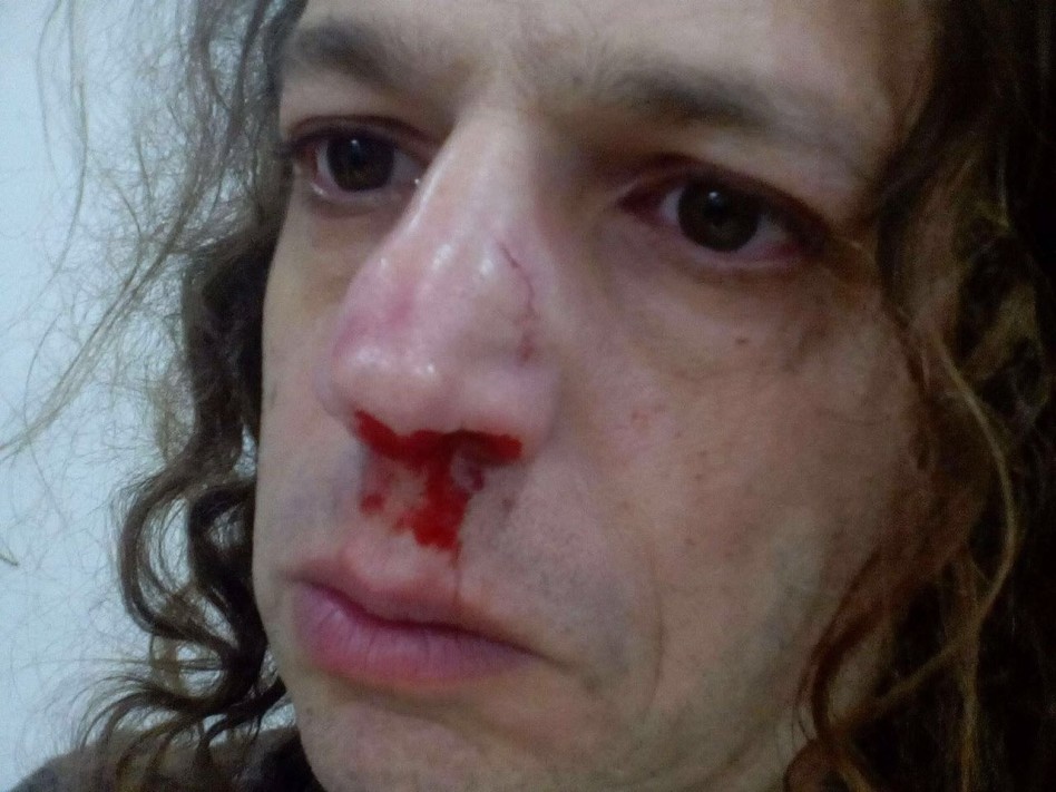 דם, צפרדע, אמיר חצרוני (צילום גולשים)