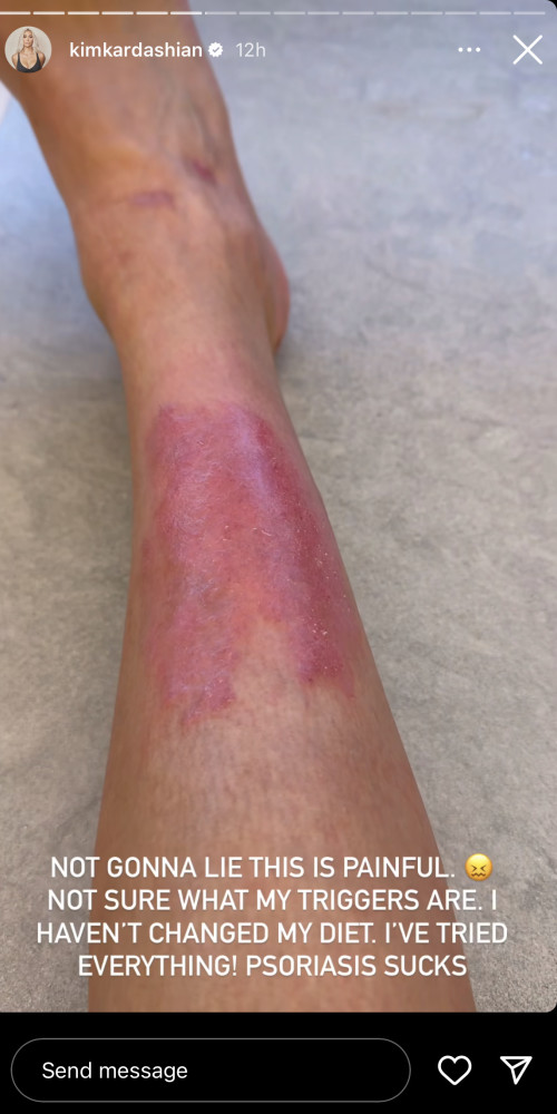 קים קרדשיאן (צילום: צילום מסך מתוך האינסטגרם)