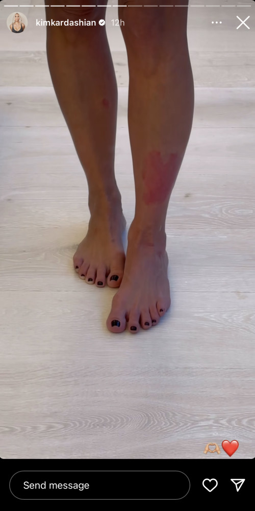 קים קרדשיאן (צילום: צילום מסך מתוך האינסטגרם)