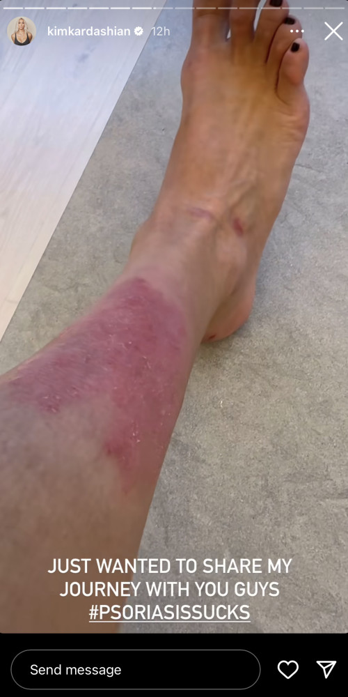 קים קרדשיאן (צילום: צילום מסך מתוך האינסטגרם)