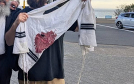 ציצית מוכתמת בדם באוסטרליה (צילום: רשתות חברתיות)