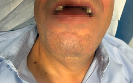 נהג האוטובוס המותקף, ירושלים (צילום: דוברות המשטרה)