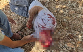 אירוע אלימות בכפר אוסרין (צילום: רשתות ערביות)