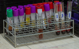 בדיקת דם (אילוסטרציה) (צילום: אינג אימג')