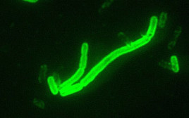 חיידק Yersinia pestis, הגורם למחלת הדבר (צילום: CDC/ Courtesy of Larry Stauffer, Oregon State Public Health Laboratory)