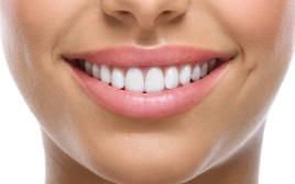 לסדר את השיניים במהירות מפתיעה, בלי פה מלא מתכת (צילום: Shutterstock)