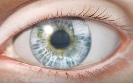 שתל מלאכותי לעין של חברת  EyeYon Medical  (צילום: יחצ)