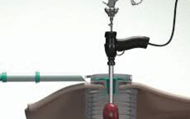 פתרון הLAP BOX