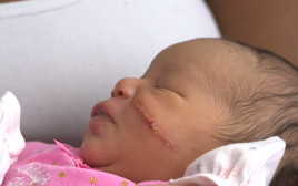התינוקת שנחתכה בזמן לידתה (צילום: GoFundMe)