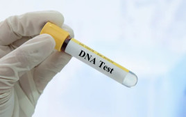 בדיקת DNA, אילוסטרציה (צילום: Getty images)