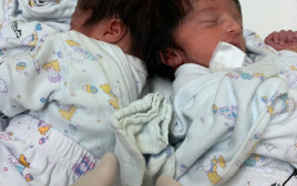 התאומות המחוברות בראשן (צילום: דוברות בית החולים סורוקה)