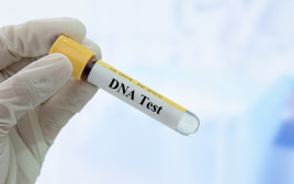 בדיקת DNA, אילוסטרציה (צילום: ingimage ASAP)