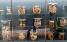 איברים משומרים בני 200 שנה מוצגים במוזיאון בווינה (צילום: Getty images)