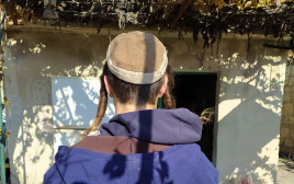 הצעיר שהותקף בירושלים, צילום פרטי (צילום: באדיבות המצולם)