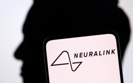 חברת Neuralink בבעלות אלון מאסק (צילום: רויטרס)