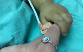 אונת כבד של אור אשכר ז"ל הושתלה בתינוק בן שנה (צילום: מרכז שניידר לרפואת ילדים)
