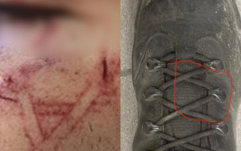 הנעל של השוטר שעל פי המשטרה גרמה לחבלה בפני העצור בשועפאט (צילום: דוברות המשטרה)