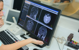 בדיקת CT, אילוסטרציה (צילום: אינג'אימג')