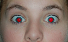 עיניים אדומות בצילום בפלאש (צילום: ויקיפדיה)
