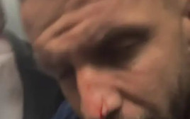 לוקאס סאשה נפצע אחרי שהאוטובוס של קבוצת פורטלזה הותקף (צילום: צילום מסך, אינסטגרם)