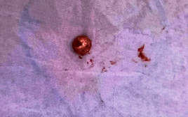 כדור המתכת שחדר לידו של הקורבן (צילום: דוברות המשטרה)