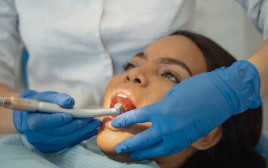 השתלת שיניים ללא כאבים: מהפכה ברפואת השיניים (צילום: pexels)